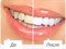 Зубная паста 5 star Herbal Clove Toothpaste 25 гр мята - фото 10318