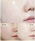 Витаминная тканевая маска (осветление) Banobagi Vita Genic Whitening jelly mask - фото 11191