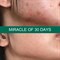 Сыворотка с кислотами для проблемной кожи Some By Mi AHA-BHA-PHA 30 Days Miracle Serum 14 ml MINI - фото 13843