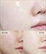 Витаминная тканевая маска (Увлажнение) Banobagi Vita Genic Hydrating jelly mask - фото 9567